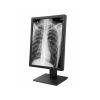 21.3寸2MP灰阶诊断医用显示器1900亮度1600*1200分辨率